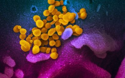 CORONAVIRUS (COVID19): Transmission, Prevention and Treatment…